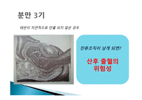 간호학 분만 기간호-5