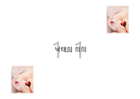 낙태 허용 문제-3