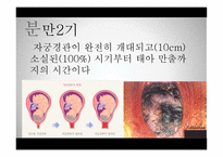 간호학 분만기 레포트-5