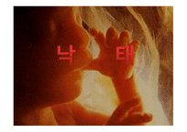 낙태 레포트-1