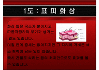 응급처치 화상 레포트-7