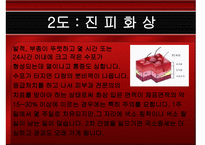 응급처치 화상 레포트-8