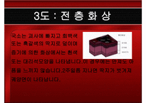응급처치 화상 레포트-9