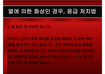 응급처치 화상 레포트-14