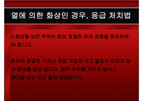 응급처치 화상 레포트-15