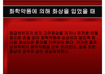 응급처치 화상 레포트-18