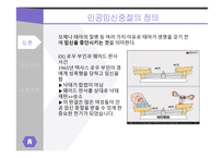 인공임신중절 찬성-2