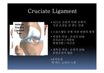 십자인대 손상 원인과 예방 및 재활방법-7