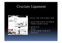 십자인대 손상 원인과 예방 및 재활방법-8