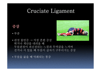 십자인대 손상 원인과 예방 및 재활방법-10