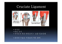 십자인대 손상 원인과 예방 및 재활방법-14