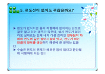 편도선 수술 레포트-6