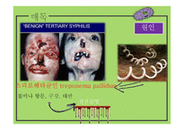 간호학 성전파성 감염-8