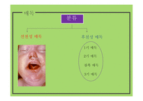 간호학 성전파성 감염-9