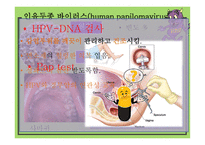 간호학 성전파성 감염-14