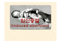 임신중절 레포트-1