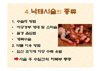 임신중절 레포트-6