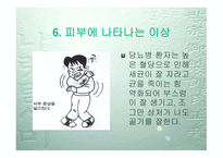 당뇨병의 원인과 증상 치료-19