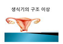 간호학 생식기 구조이상 생식기 기형 성선 발육장애 자궁의 위치 이상-1