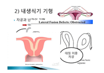 간호학 생식기 구조이상 생식기 기형 성선 발육장애 자궁의 위치 이상-7