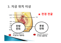 간호학 생식기 구조이상 생식기 기형 성선 발육장애 자궁의 위치 이상-10