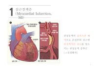 간호학 심근경색-3