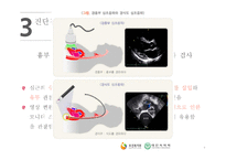 간호학 심근경색-7