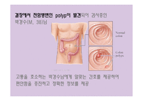 간호학 결장직장암 치료와 간호-2