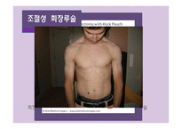 간호학 결장직장암 치료와 간호-6