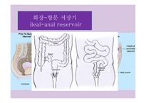 간호학 결장직장암 치료와 간호-8