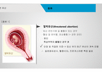 간호학 자연유산-4