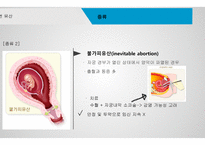 간호학 자연유산-5