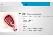 간호학 자연유산-6