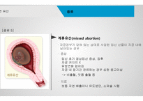 간호학 자연유산-8