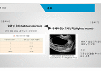 간호학 자연유산-9