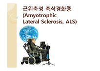 간호학 근위축성 축삭 경화증 AmyotrophicLateral Sclerosis ALS-1