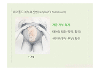 간호학 산전관리-8