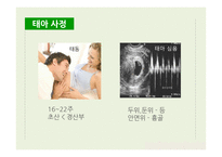 간호학 산전관리-13