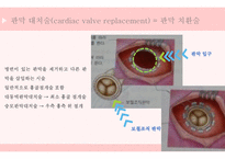 간호학 관상동맥질환_-6