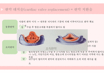 간호학 관상동맥질환_-8