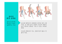 간호학 외과적 치료 판막 교정술 판막치환술-5