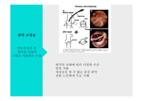 간호학 외과적 치료 판막 교정술 판막치환술-6