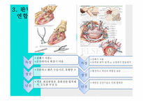 간호학 외과적 치료 판막 교정술 판막치환술-8