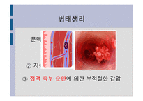 간호학 문맥 성고 혈압 과식 도정 맥류 간호-4