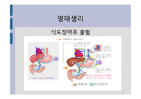 간호학 문맥 성고 혈압 과식 도정 맥류 간호-5