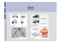 간호학 문맥 성고 혈압 과식 도정 맥류 간호-6