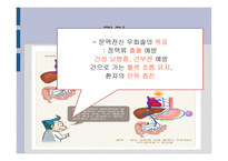 간호학 문맥 성고 혈압 과식 도정 맥류 간호-13