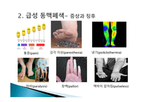 간호학 동맥경화증 급성 만성 동맥 폐색 대상자 간호-4