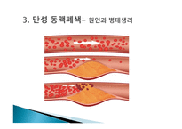 간호학 동맥경화증 급성 만성 동맥 폐색 대상자 간호-7