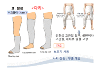 간호학 골절의 비수술적 관리-7